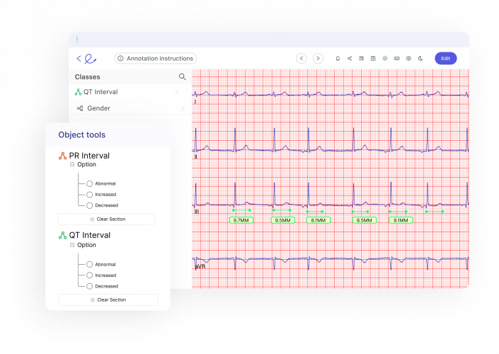 AI ECG Interpretation: Revolutionizing electrocardiogram interpretation through AI. screenshot 4