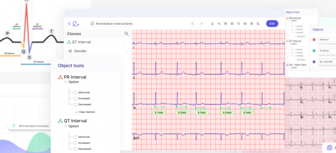 AI ECG Interpretation: Revolutionizing electrocardiogram interpretation through AI. screenshot 2