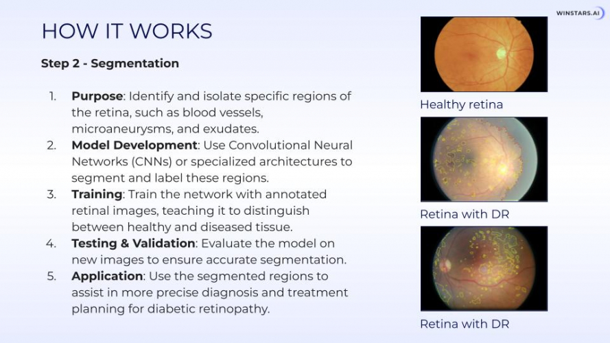 AI-Based Diabetic Retinopathy Detection screenshot 5