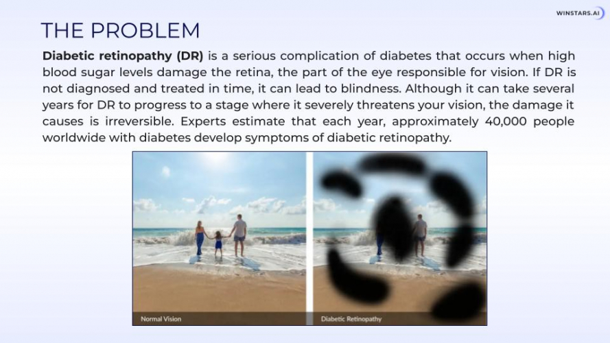 AI-Based Diabetic Retinopathy Detection screenshot 2