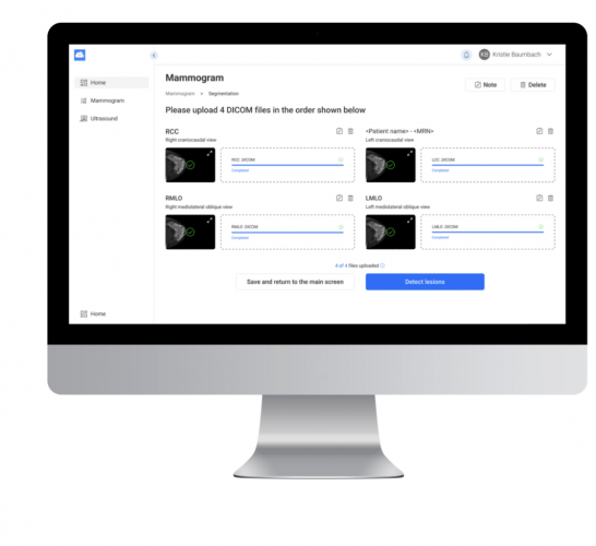 AI breast cancer detection platform screenshot 1