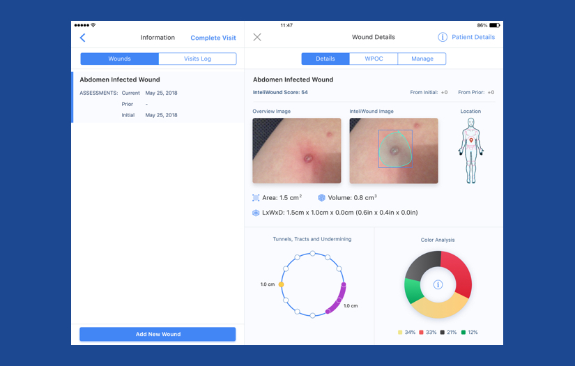 Inteliwound screenshot 1