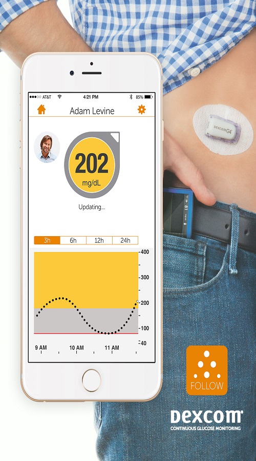 Dexcom screenshot 2