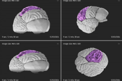 3D Medical Imaging Software Development