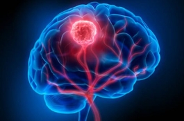 Brain Tumor Localization Application