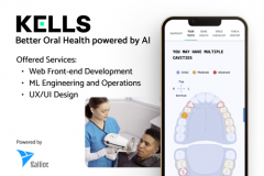 AI Driven Oral Screening Solution