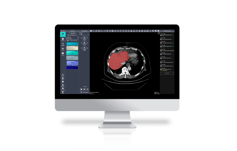 eMedical Imaging AI Platform screenshot 1