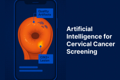 Cervical Cancer Screening with AI: Faster, Scalable, and Accurate Diagnostics