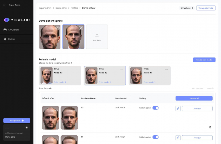 Hair Transplant Simulations screenshot 3