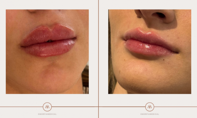 Enhancing the beauty screenshot 2