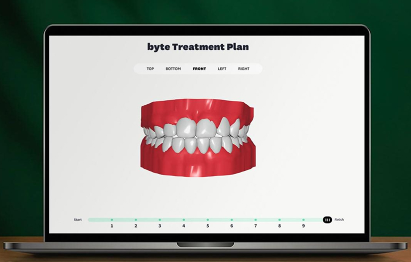 ByteMe 3D Treatment Viewer Web Application screenshot 1