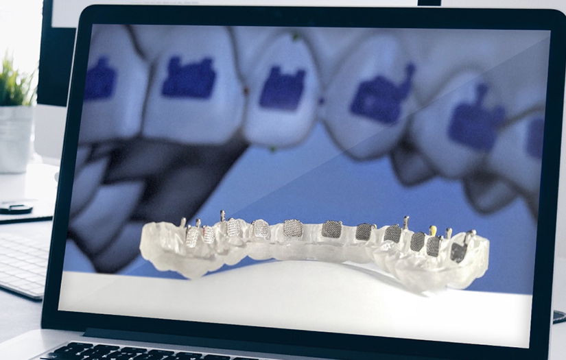 OrthoSelect Desktop Application screenshot 1