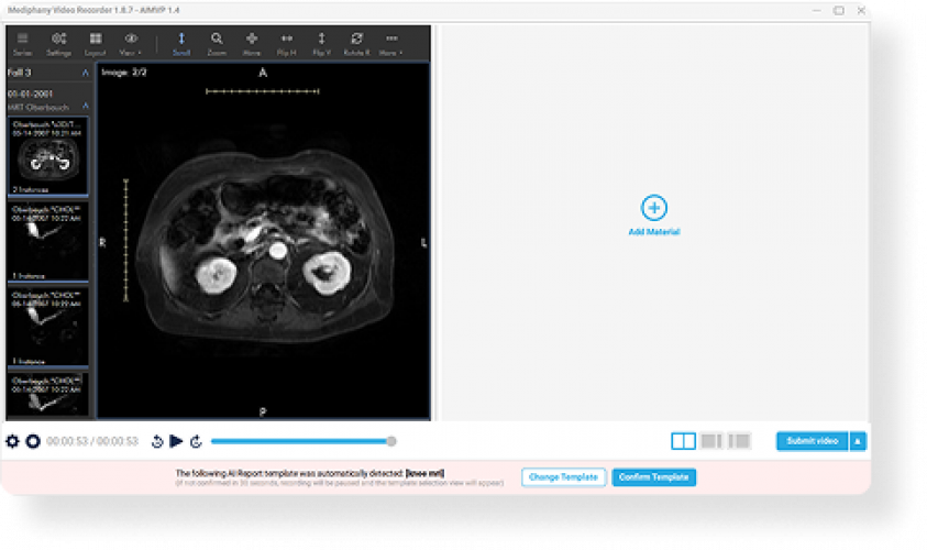 Mediphany: AI-Powered Radiology Reporting Platform screenshot 1