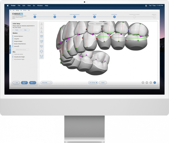 DIBS AI: AI-Enhanced Orthodontic Treatment Planning screenshot 2