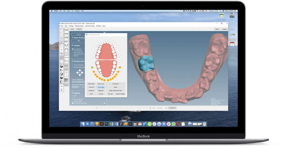 DIBS AI: AI-Enhanced Orthodontic Treatment Planning screenshot 1