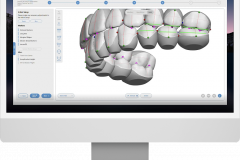 DIBS AI: AI-Enhanced Orthodontic Treatment Planning