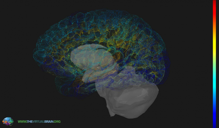 The Virtual Brain screenshot 1