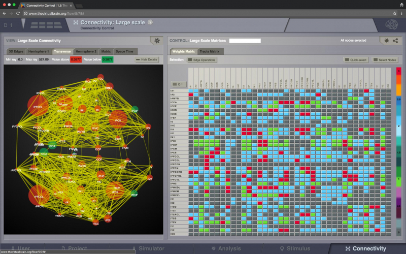 The Virtual Brain screenshot 3