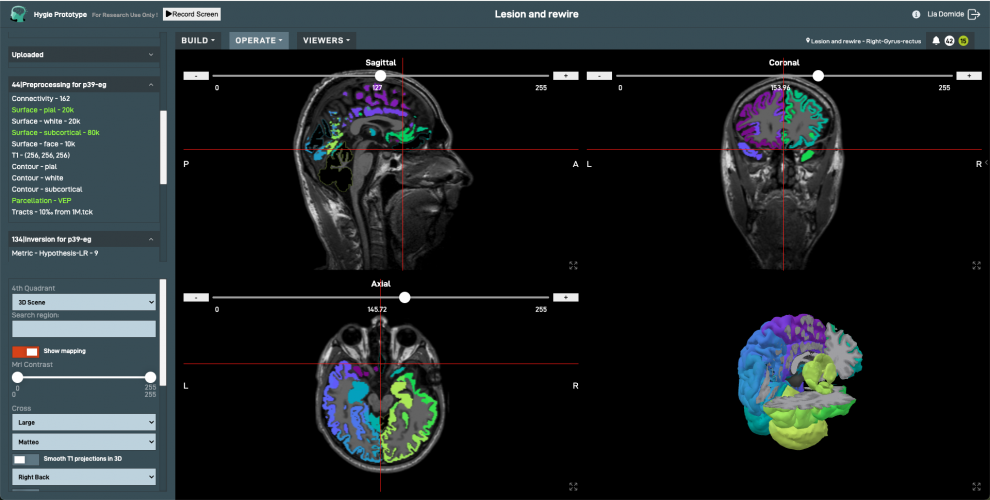 Hygie: Brain exploration in your browser screenshot 4