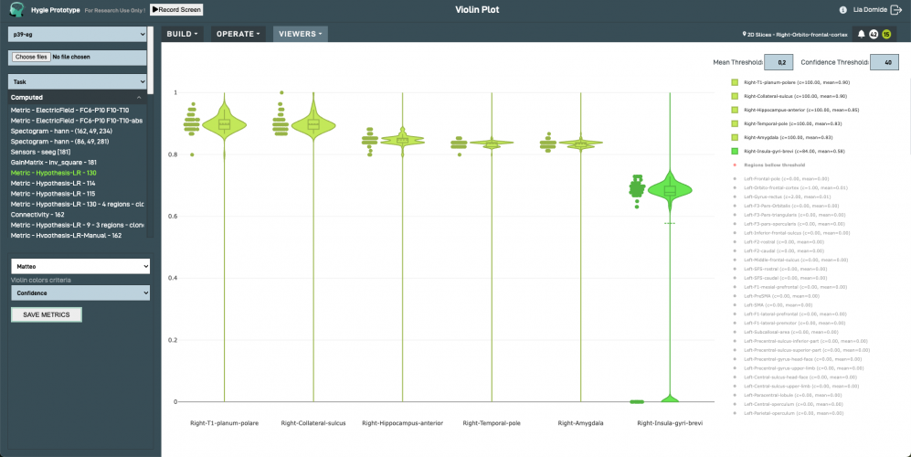 Hygie: Brain exploration in your browser screenshot 1