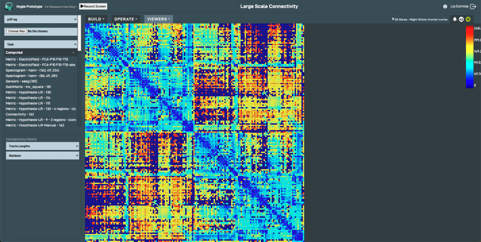 Hygie: Brain exploration in your browser screenshot 3