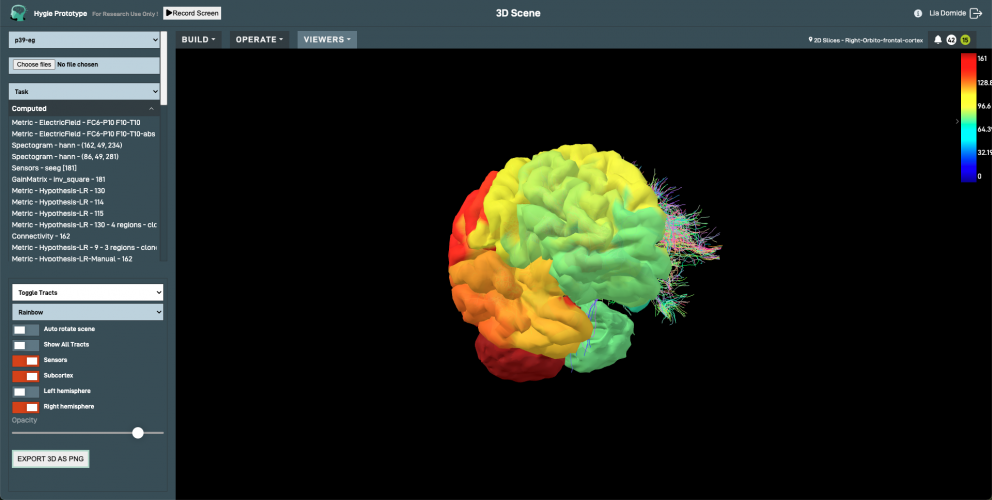 Hygie: Brain exploration in your browser screenshot 2