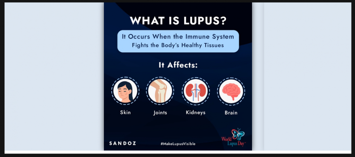 Sandoz – Corporate Branding Through Content Marketing screenshot 1