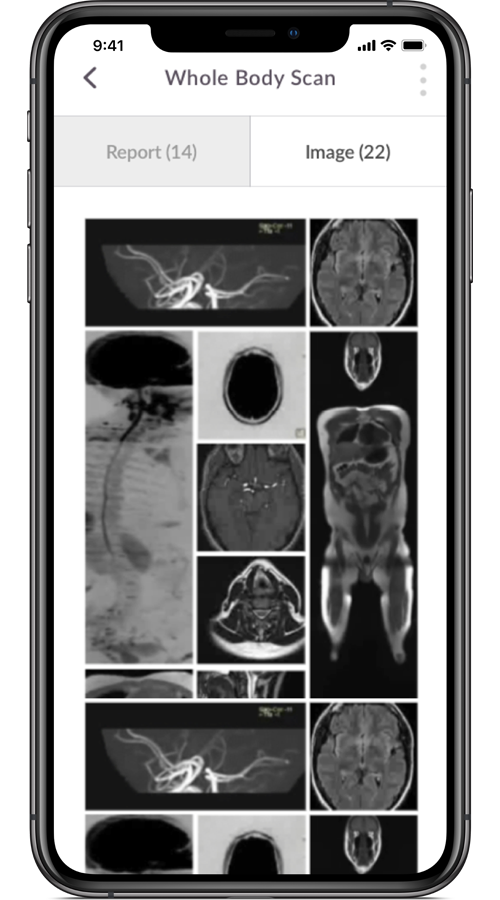 Prenuvo - iOS and Android Apps for Medtech Company screenshot 2