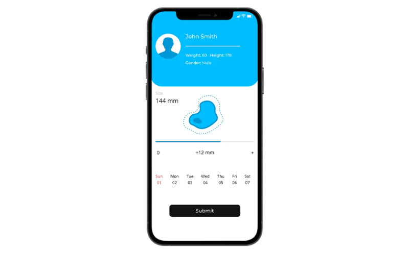 Automated Melanoma Prevention & Detection screenshot 3
