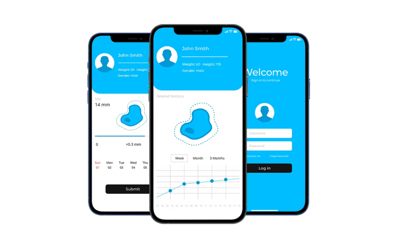 Automated Melanoma Prevention & Detection screenshot 4