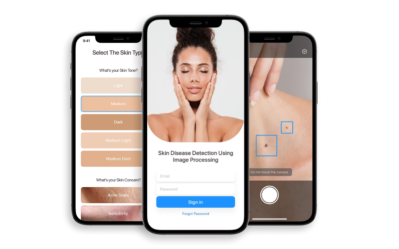 Skin Disease Detection with AI-Powered Image Recognition screenshot 3