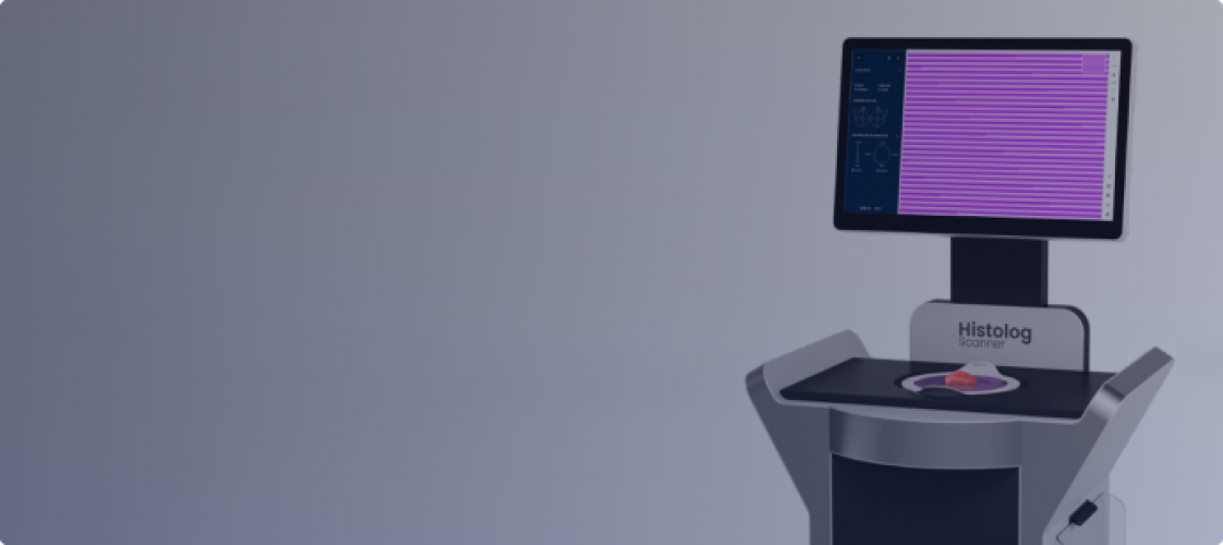 Set of Data Analytic Tools for Breast Conserving Cancer Surgery screenshot 1