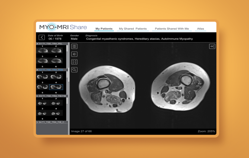 MYO-Share screenshot 1