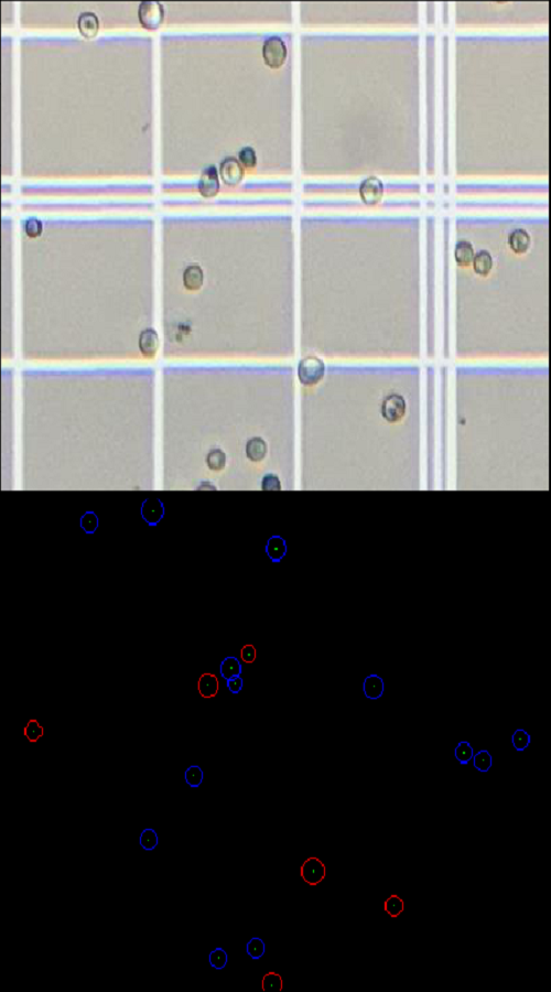 An algorithm to recognize dead and live cells in yeast images screenshot 2