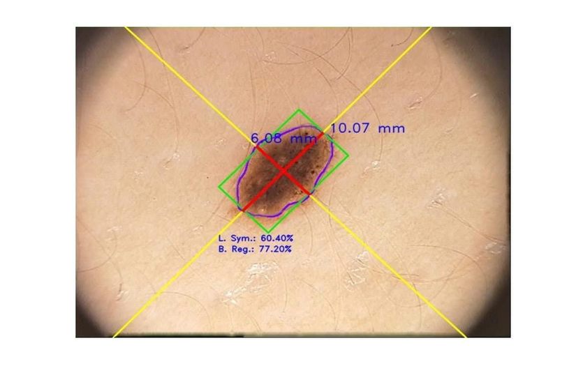 SkinView iOS Application screenshot 1