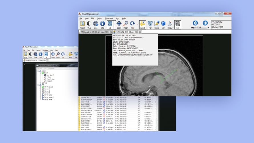AlgoM DICOM Viewer screenshot 1