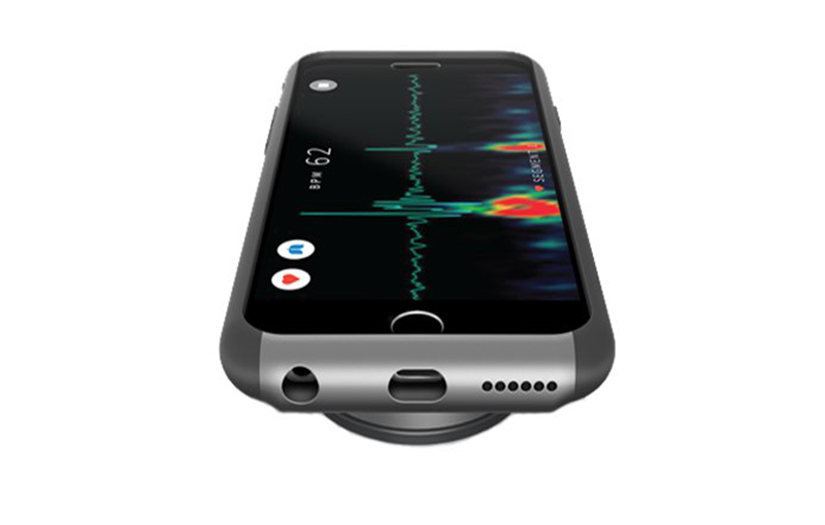 Stethio screenshot 1