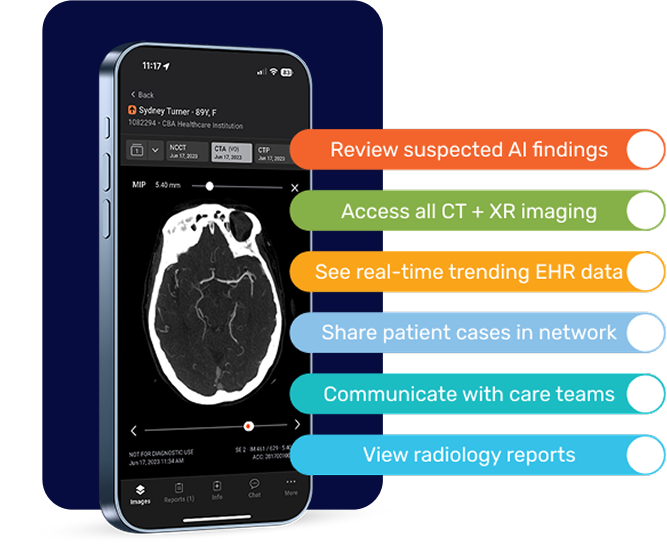 Aidoc screenshot